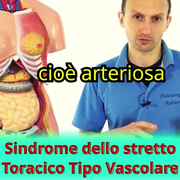 Sindrome dello Stretto Toracico di Tipo Vascolare