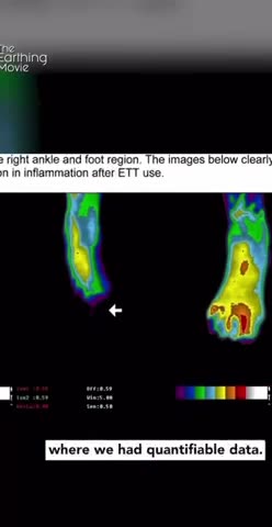 Earthing is back to nature!
