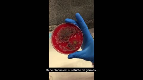 MICROBIOLOGIE - Une très curieuse culture (VOSTFR)