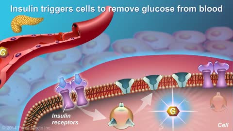 Green Veggie INFLAMES Type 2 Diabetes (Avoid)