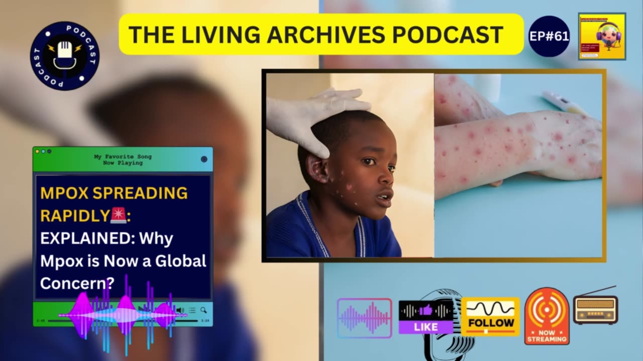 MPOX SPREADING RAPIDLY🚨: Know All Details, Plus Why Mpox is Now a Global Concern?