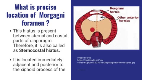 Morgagni Hernia Explained | Retrosternal & Parasternal Hernia | Novice Medic