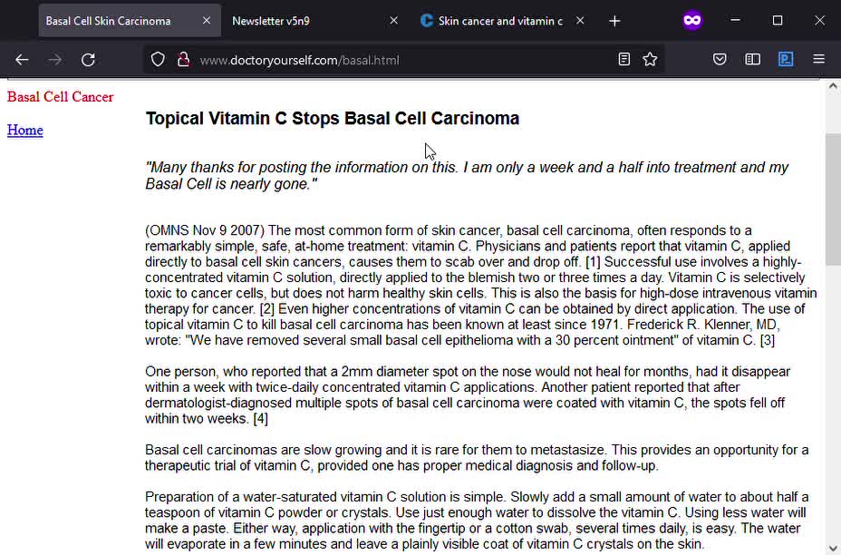 Treating Basal Cell Skin Carcinoma, Age Spots, and Solar Keratosis with Vitamin C