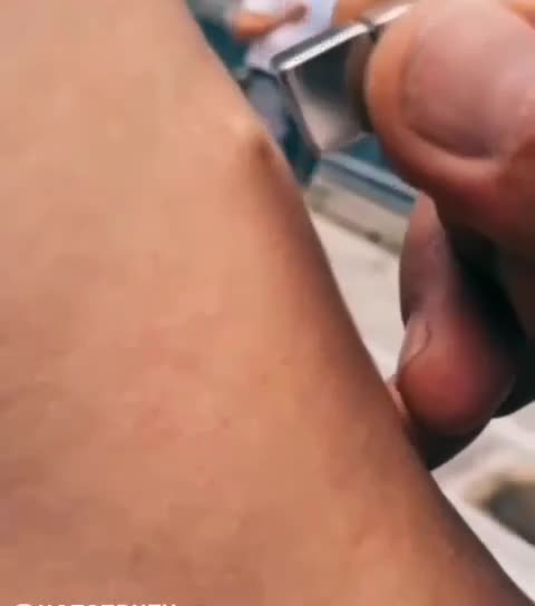DEATH VAX The Magnetic Pulls The Skin Of The Injection Point