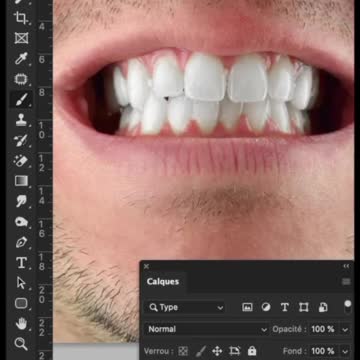 Yellow Teeth 😭 | Learn Photoshop