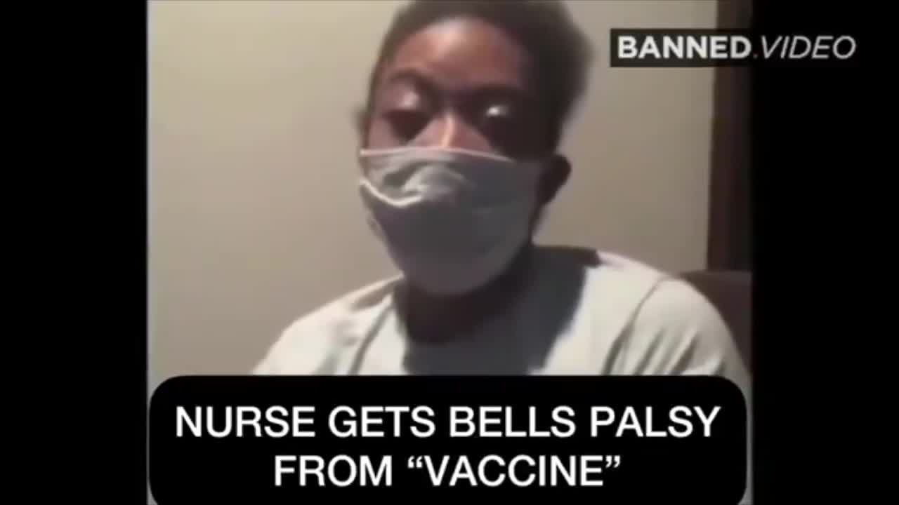 Nurse gets Bells Palsy from covid vaccine