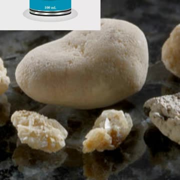 इन लक्षणों का मतलब किडनी में बन रहा है स्टोन