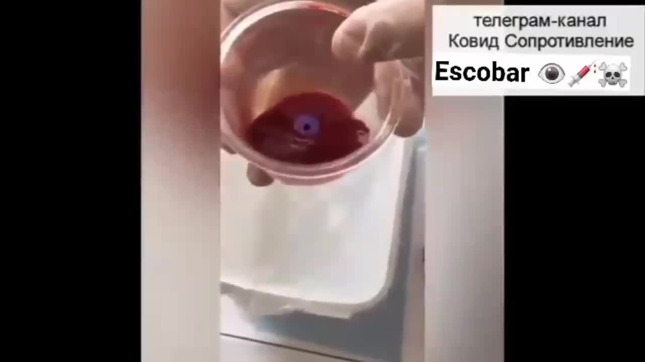 Что содержится в вакцинах? What are in vaccines?