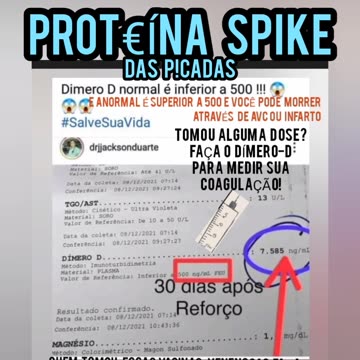 Quem tomou a vacina faça esse exame DÍMERO-D