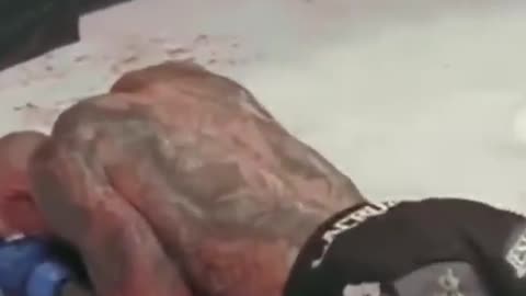 One Of Worst Ever Injury,s