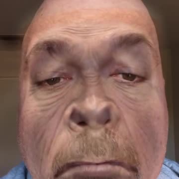 I do not condone making fun of Monkey Pox.