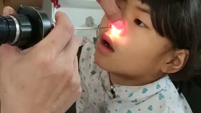 소녀의 코 속 깊숙히 있다가 꺼내진 '이 것'의 정체 (약혐주의)