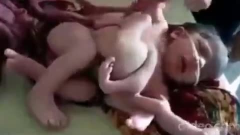 Human Animal Hybrids & Black-eyed Babies