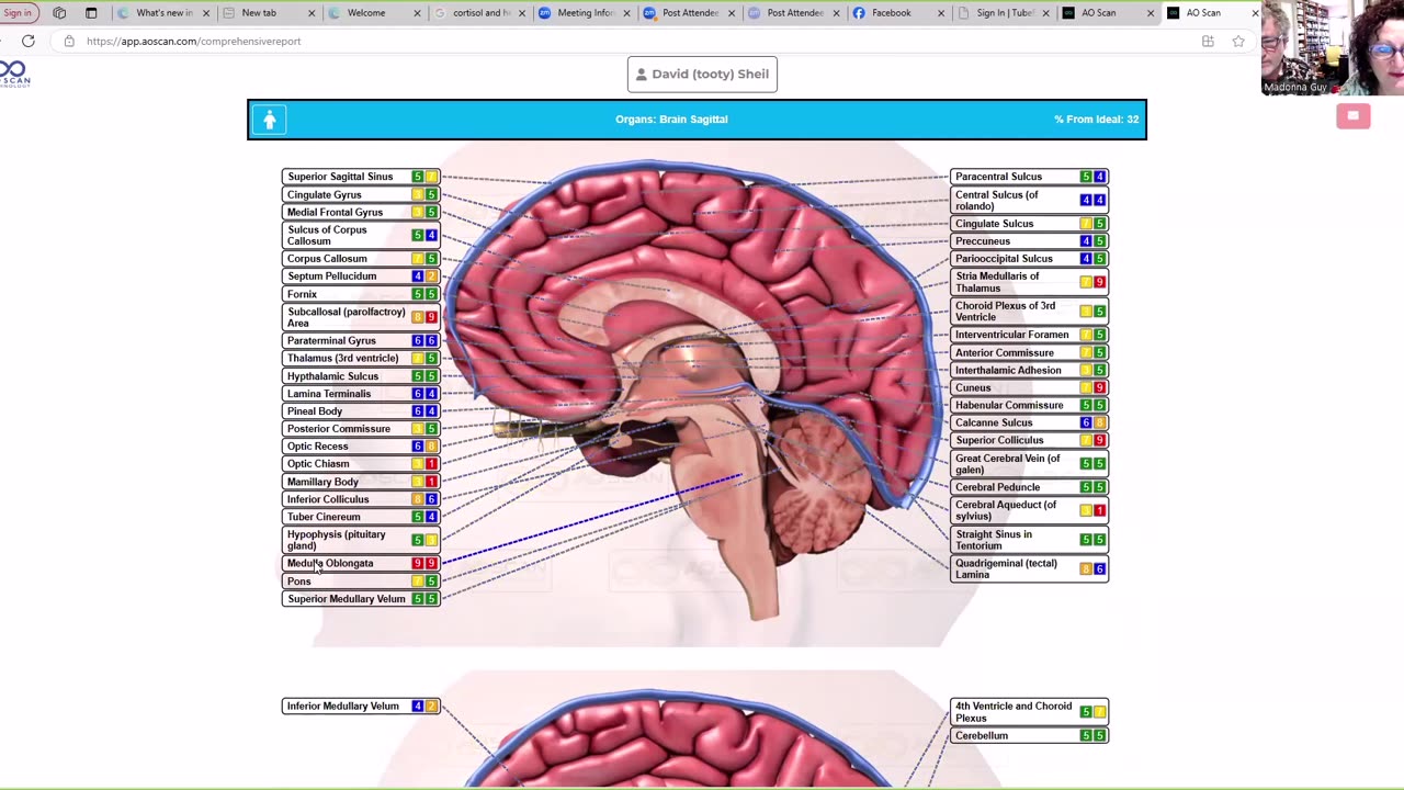 AO Scanner Update - How to run a Solex Comprehensive Scan & get full visuals!