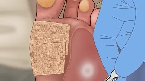 FOOT TREATMENT ASMR