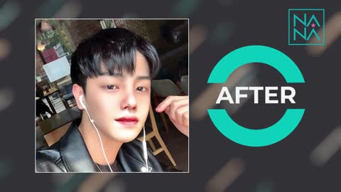 TOP 5 Dramatic Plastic Surgery Transformations before and after NANA HOSPITAL KOREA