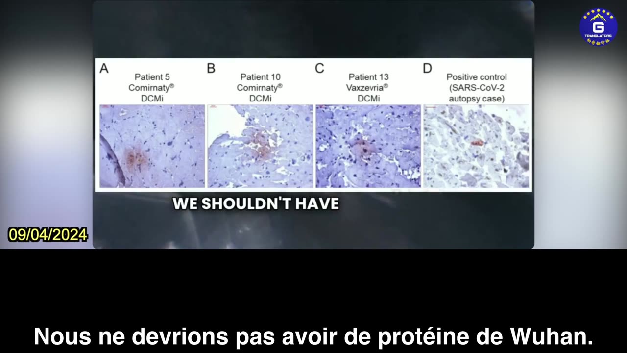 【FR】Dr. McCullough : De nombreuses recherches montrent que le vaccin COVID endommage le cœur