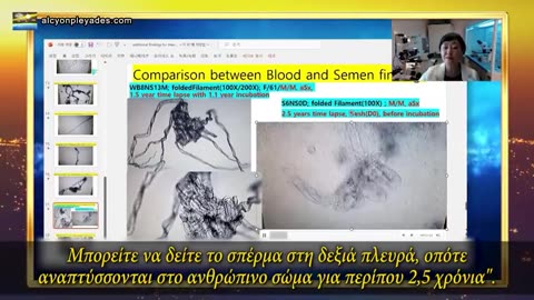 Νημάτια αυτοσυναρμολογούνται, αναπτύσσονται στη σπερματική ύλη και επηρεάζουν τη γονιμότητα !