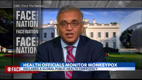 Monkeypox is spreading faster than the data about it, hindering mitigation efforts