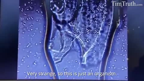 Why Are Cytotoxic Carbon NanoTubes or NanoWorms Found In mRNA Vaccines?