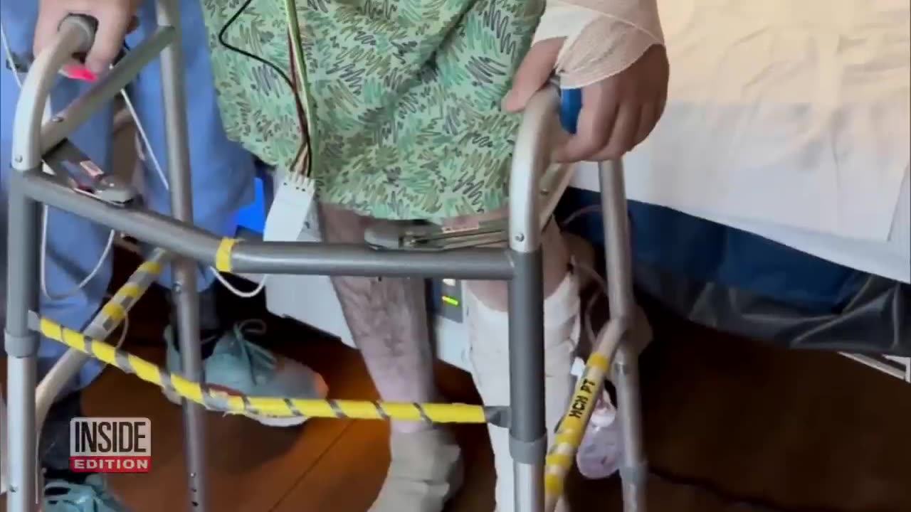 61-Year-Old Man Lucky To Be Alive After A Grizzly Bear Bit Off....