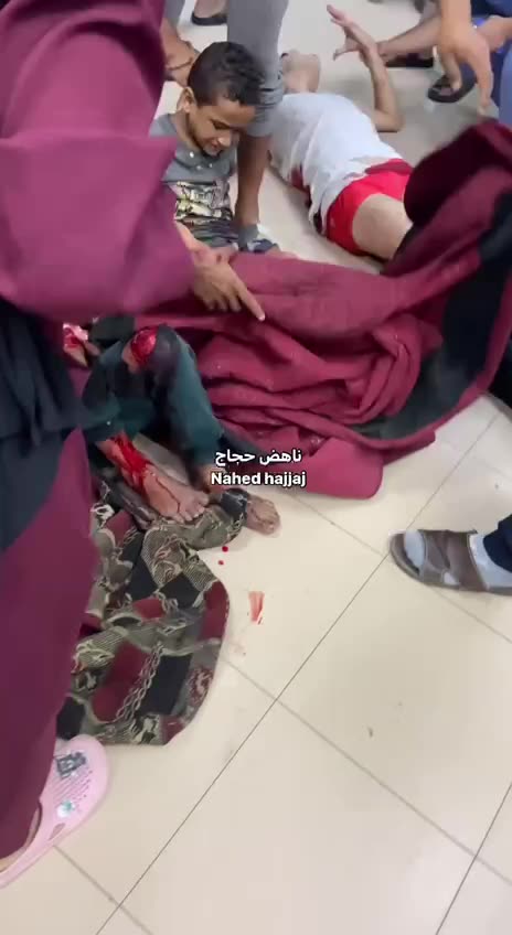 Bambini gravemente feriti dalle bombe israelo-americane.