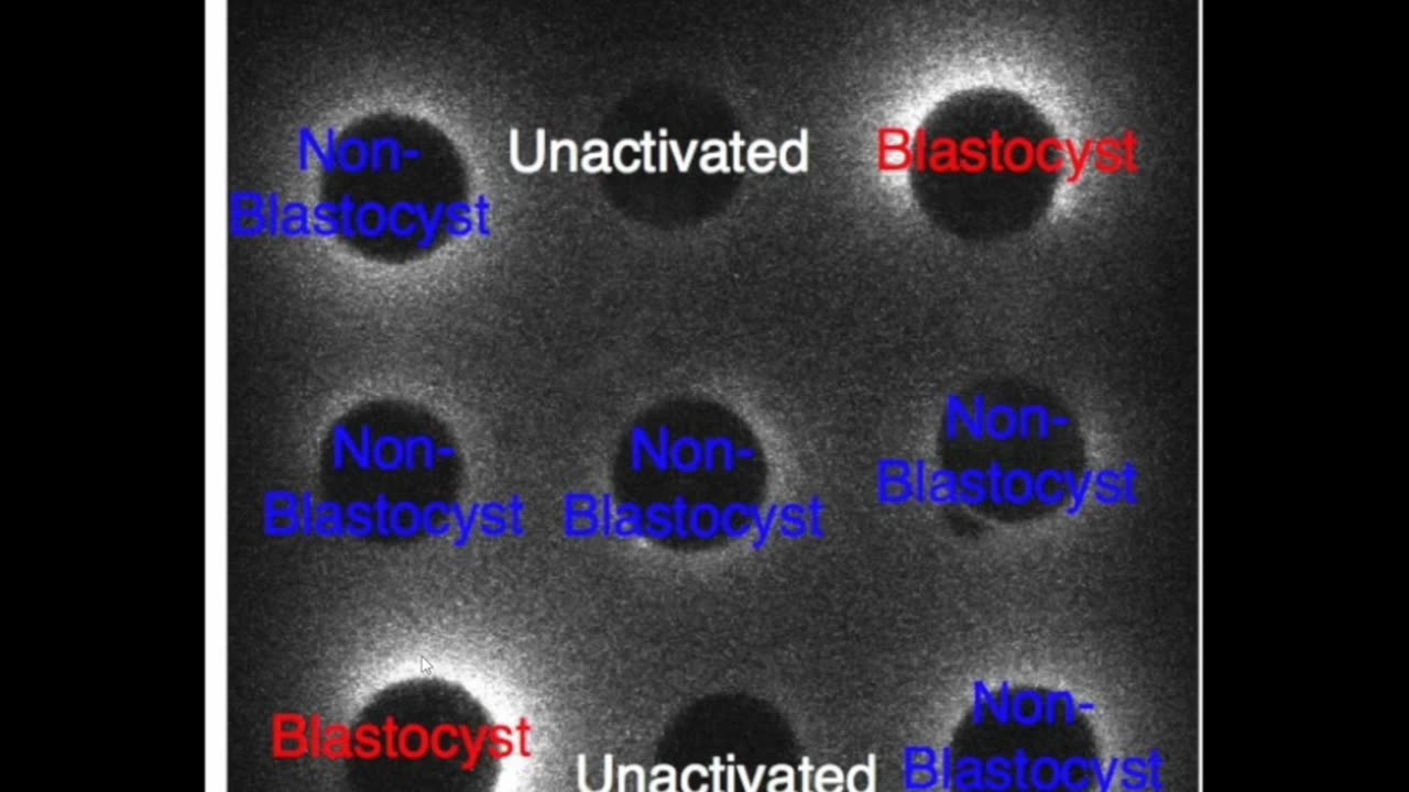 The Incredible Zinc Burst at Fertilization Revealed