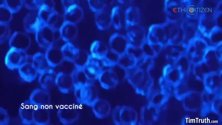 French Doctors Analyse Blood of Vaxxed