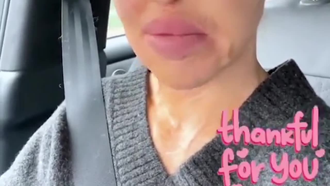 Katie Piper reveals she got a defect and an infection in her eye