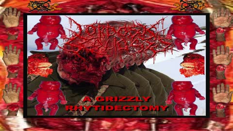 LORDOSIS SCOLIOSIS - A GRIZZLY RHYTIDECTOMY (2021) 🔨 FULL EP 🔨
