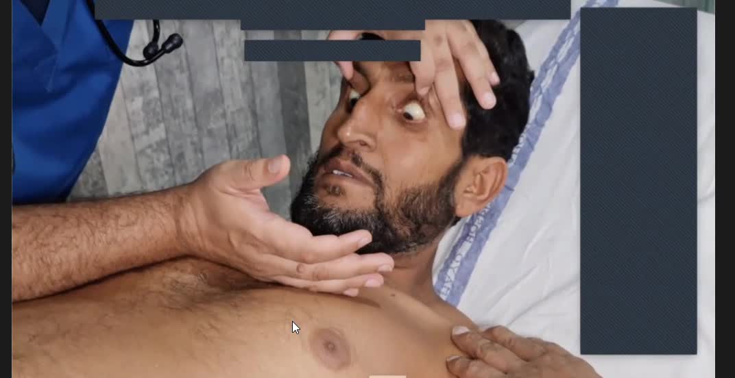 ST1.Examine the abdomin of this patient