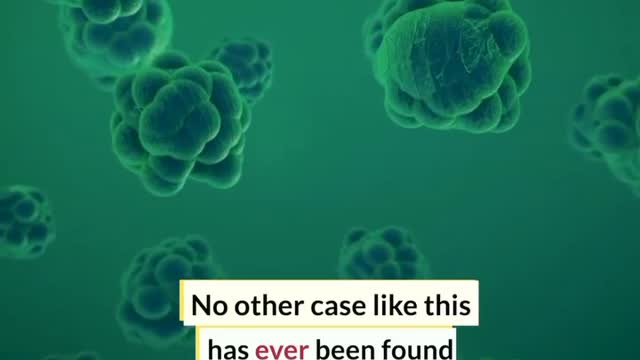 Women With 12Tumor