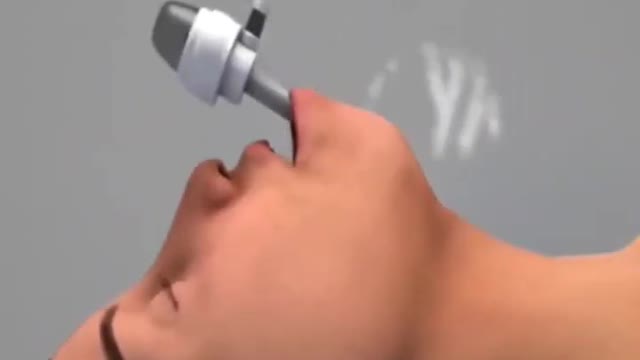 How thyroid gland is removed (3D Animation)