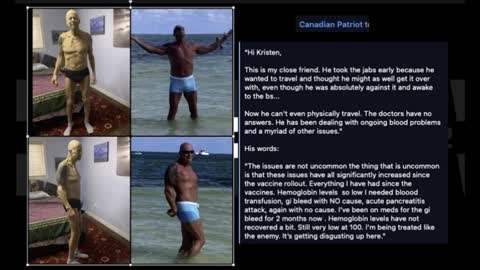 More Lies from NZ - Dr Anfras house raided during recording about jab clots