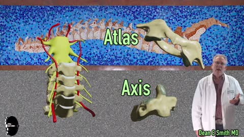 Anterior Cervical Decompression and Fusion