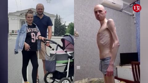 Russians tortured captured Ukrainian soldier into this state - he lost 38 kg