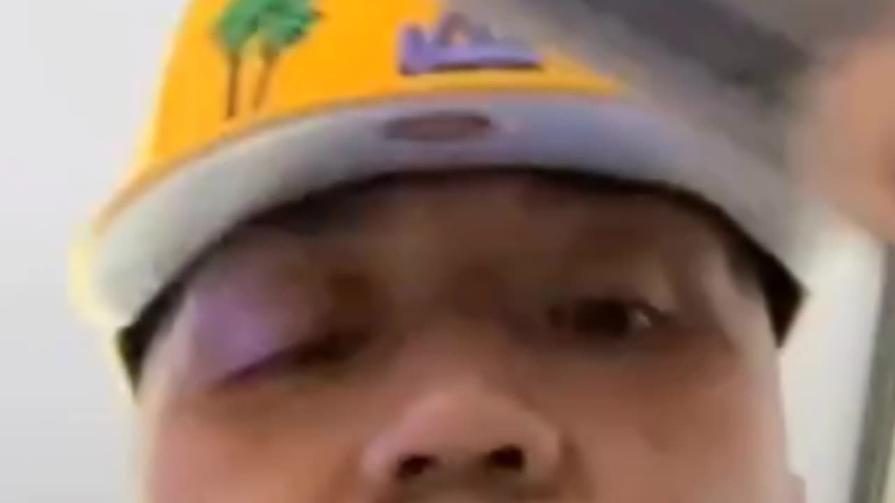 China Mac Shows His Face After Alleged Altercation