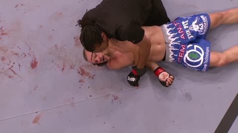 Chuck Liddell KO/TKO Losses