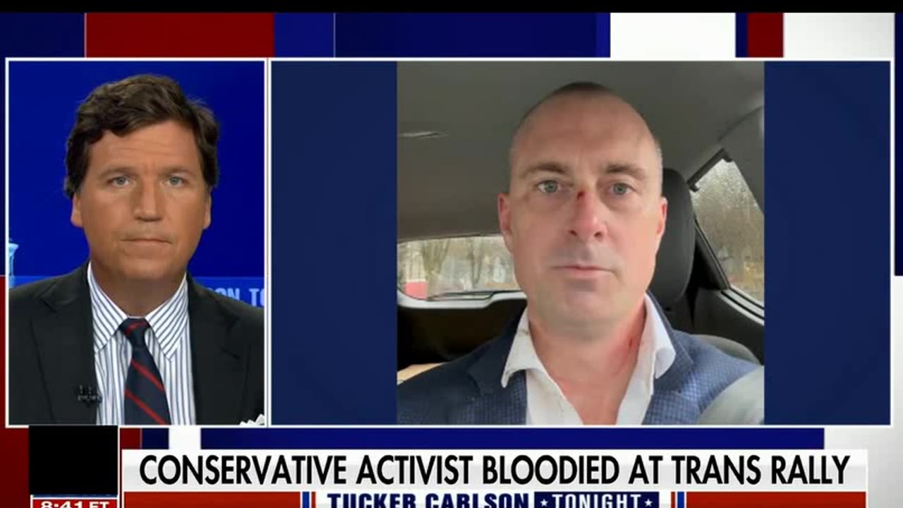 TUCKER CARLSON: The most shocking video of the year unreal. Trans woman uses full male force an innocent by standard cuts his face and criminal cop lies, Vancouver police chief backs the lying political cop on video. All documented on VIDEO WOW. Vancouver