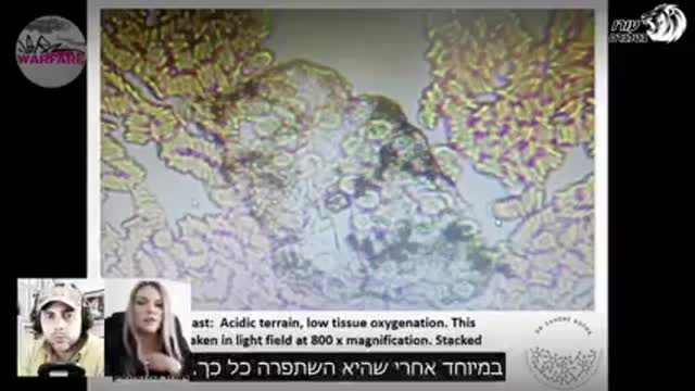 לא תאמינו, מה קורה בתוך הדם של האנשים אחרי החיסון