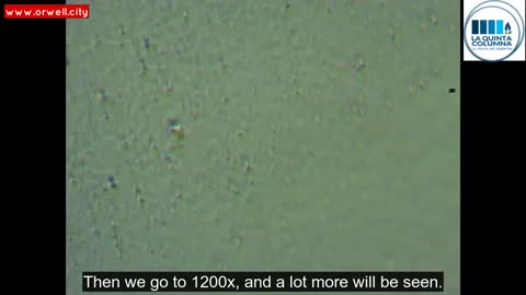 New Pfizer vaccine images with what is inside them