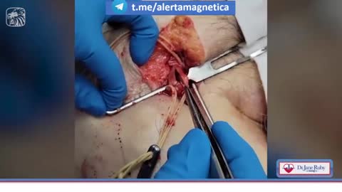 Dr. Jane Ruby 2: imbalsamatore estrae coaguli dalle arterie...