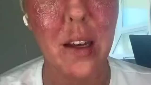 Vaccine 💉 Injury