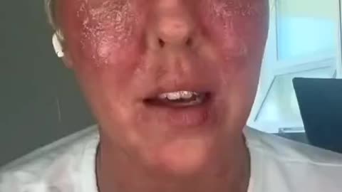 Vaccine 💉 Injury