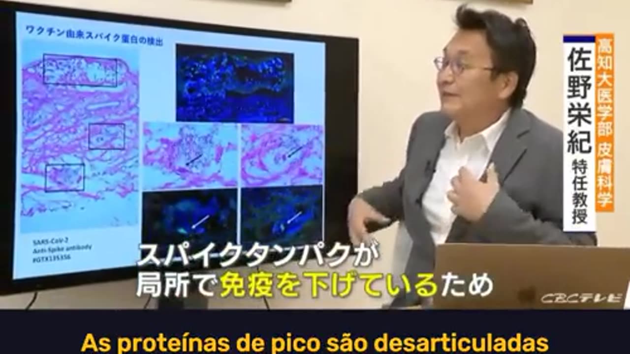 O Japão ja havia falado sobre as Reações Adversas Graves causadas pelas doses de mRNA