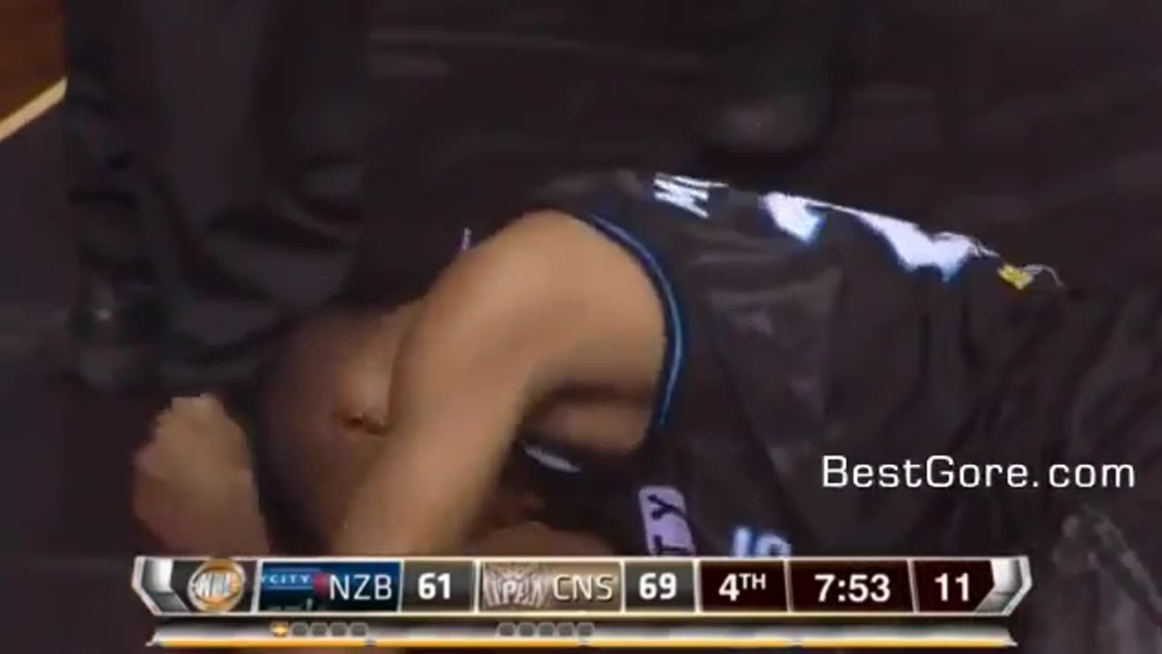 Eye comes out of socked in the basketball game