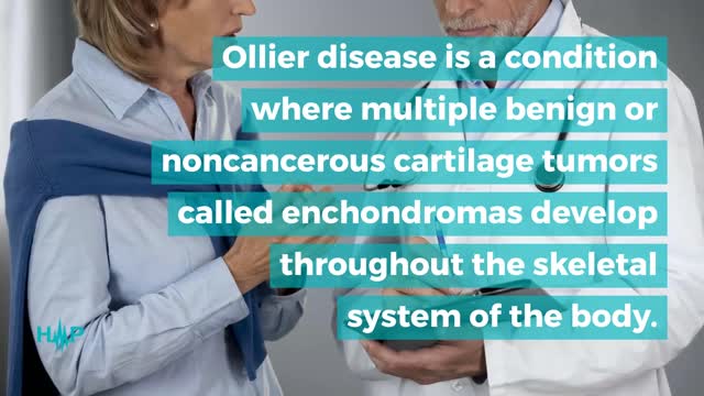 What Increases The Risk Of Chondrosarcoma?