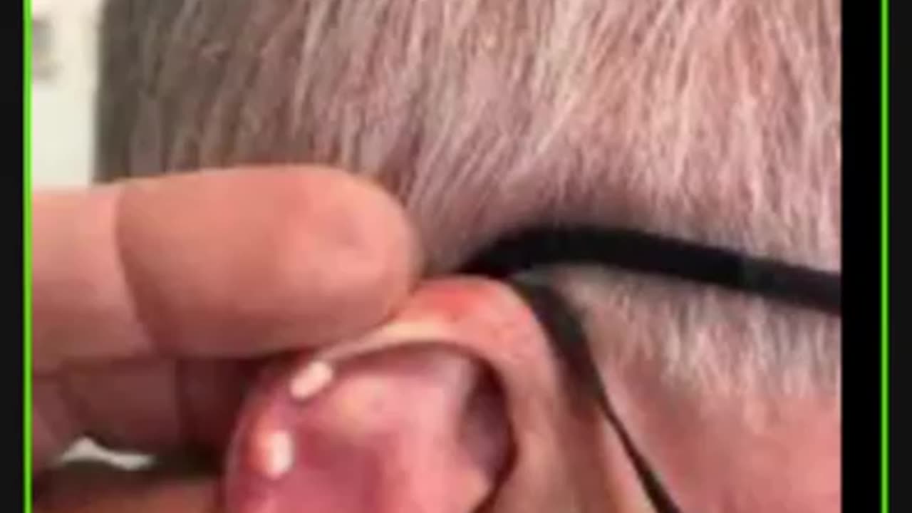 ST5.65 year old man with joint pain, ST5.32 year old lady with collapse