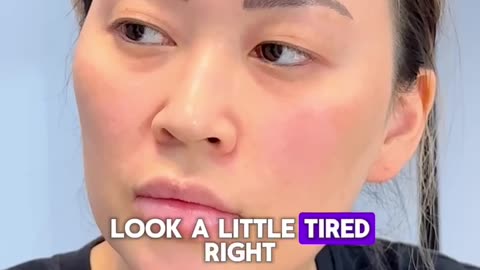Ptosis & Double Eyelid Surgery: Pre-Op Journey Part 2 | Addressing Tired Eyes with Dr. Kenneth Kim