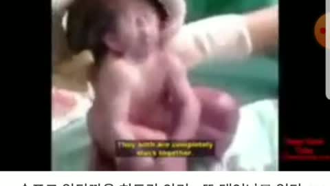 접종현상(히드라 베이비)